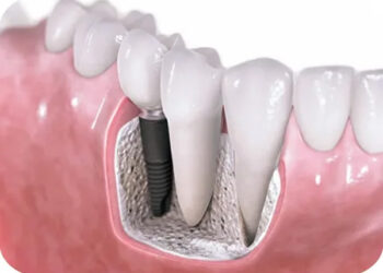 Periodoncia-diagnostico-tratamiento